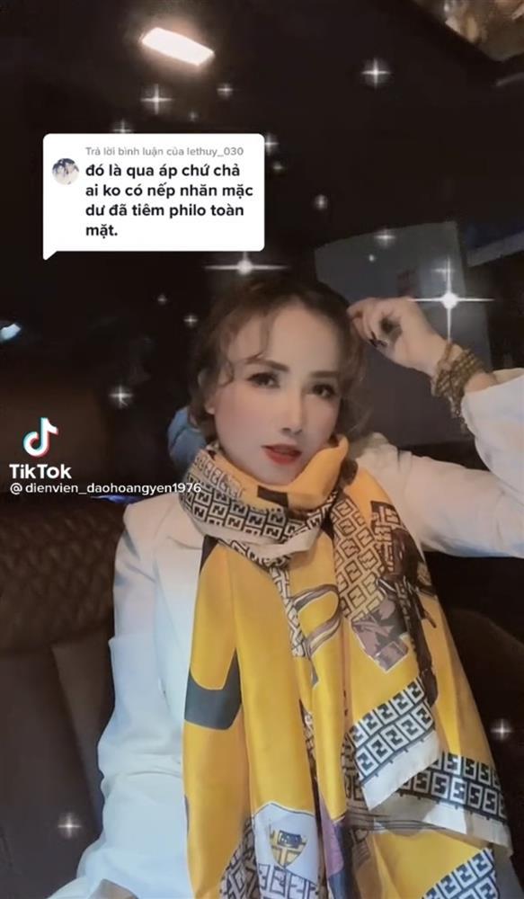 Cô Xuyến Hoàng Yến tặng 1 tỷ cho người phát hiện mình tiêm filler-2