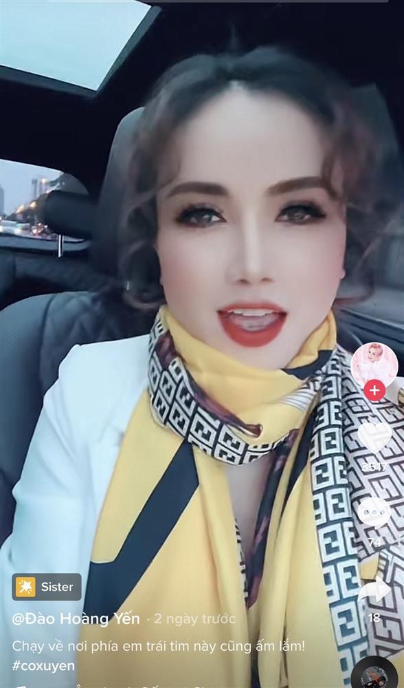 Cô Xuyến Hoàng Yến tặng 1 tỷ cho người phát hiện mình tiêm filler-3