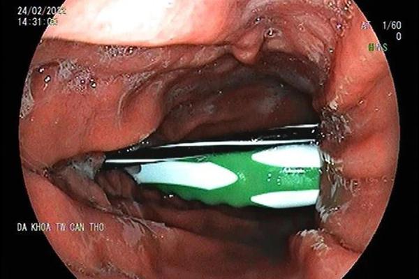 Cụ ông 93 tuổi đánh chết vợ 89 tuổi vì nghi cho ông hàng xóm tiền-4