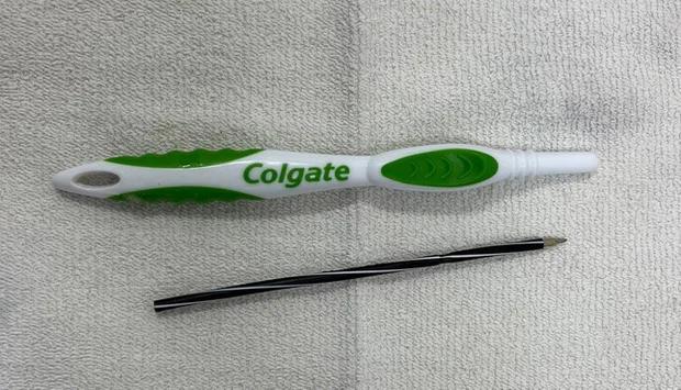 Mải làm việc, thanh niên nuốt đầu bút bi, bàn chải đánh răng vào bụng-2