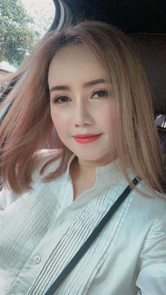 Mặt mộc cô Xuyến thế nào mà tặng 1 tỷ cho ai phát hiện tiêm filler?-9