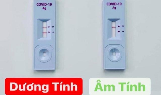 Test nhanh Covid-19 thế nào để hiệu quả, ít tốn kém?-1