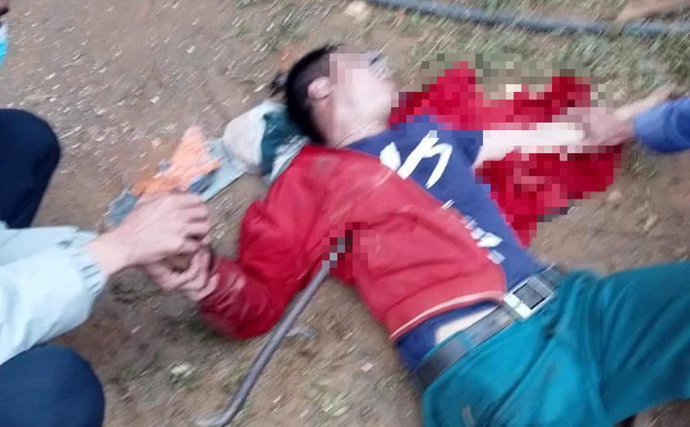 Chiếc xà beng sắt dài hơn 1 mét đâm xuyên ngực người đàn ông-1