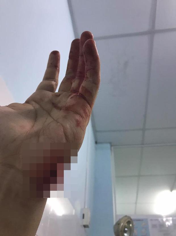 Nam ca sĩ điển trai bị chém vì còng lưng gánh nợ cho mẹ giờ ra sao?-5