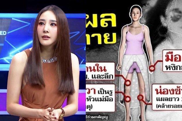 Mỹ nhân Chiếc Lá Bay bị kéo lê thi thể trước khi tử vong?-5