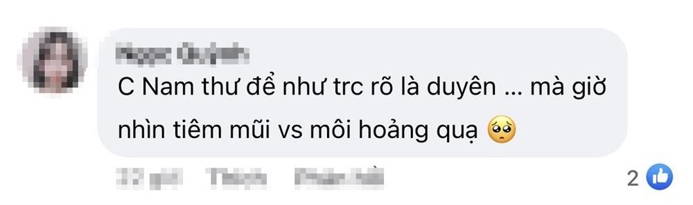 Nam Thư mặt biến dạng như thẩm mỹ hỏng, nghi vấn lại trùng tu-3