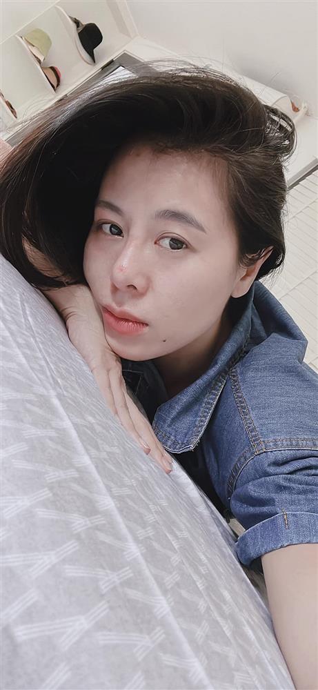 Nam Thư mặt biến dạng như thẩm mỹ hỏng, nghi vấn lại trùng tu-7