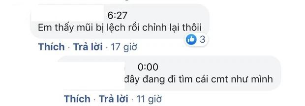 Nam Thư mặt biến dạng như thẩm mỹ hỏng, nghi vấn lại trùng tu-10