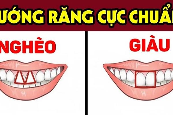 5 kiểu răng xấu phá tướng, chặn đứng hoàn toàn mọi tài lộc-3