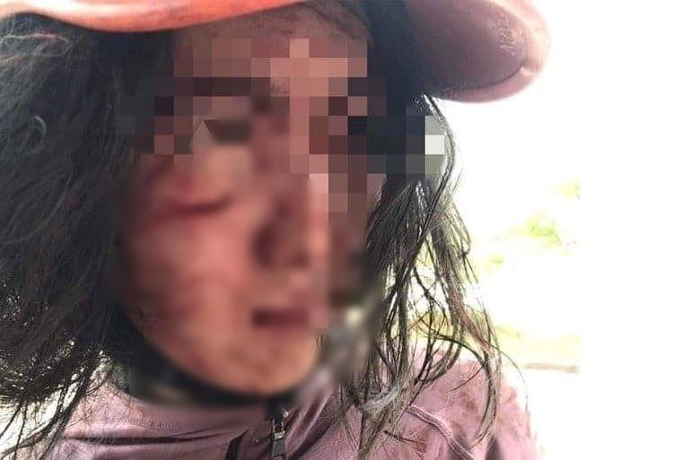 Vợ bị chồng chặn đường đánh đập, rạch mặt khi đi làm thủ tục ly hôn-1