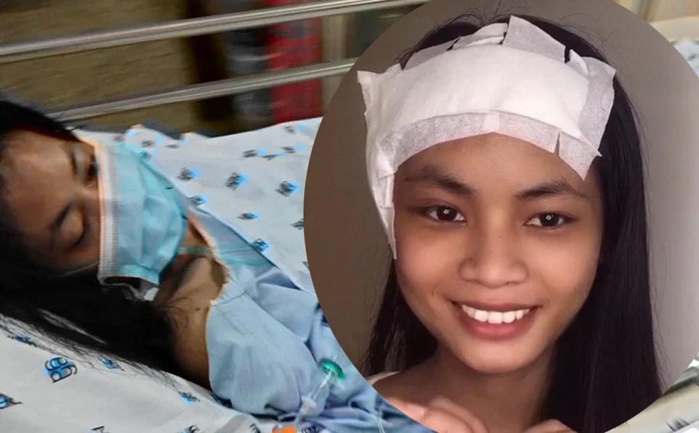 Người mẫu Châu Kim Sang: 2 năm 5 lần phẫu thuật, 4 lần mổ sọ-3