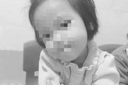 Bé gái 3 tuổi bị tình nhân của mẹ đóng 9 đinh vào đầu qua đời