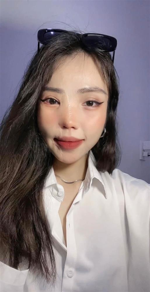 Không nhận ra cô gái Đà Nẵng bị hôn phu tạt axit 3 năm trước-3