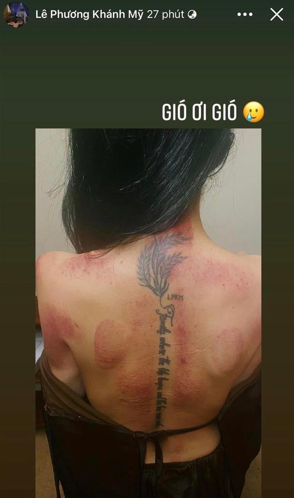 Vân Navy bị chồng đánh, thương tích đầy mình?-2