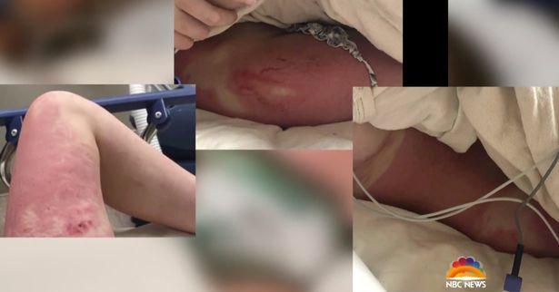 Cô gái bị bạn thân xô xuống thác nước suýt mất mạng giờ ra sao?-3