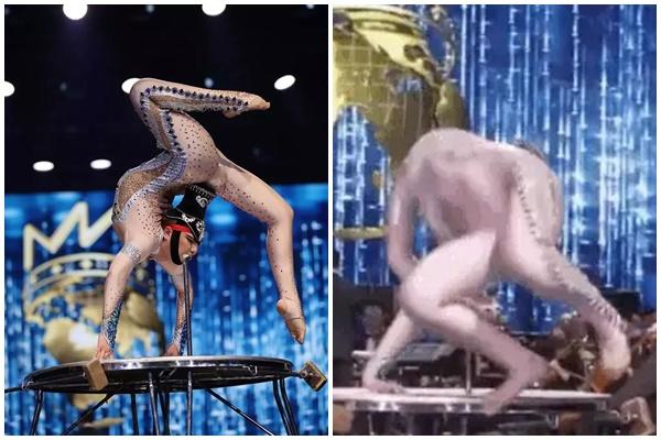 Màn tuốt mặt kỳ diệu của Á hậu Miss World sau tai nạn bỏng nặng-12