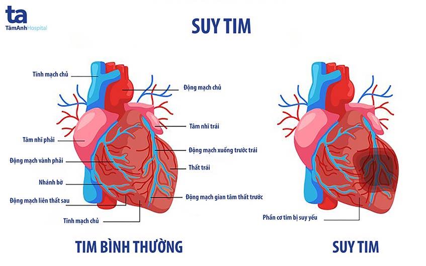 Căn bệnh nào đã mang nhạc sĩ Ngọc Châu ra đi sớm thế?-2