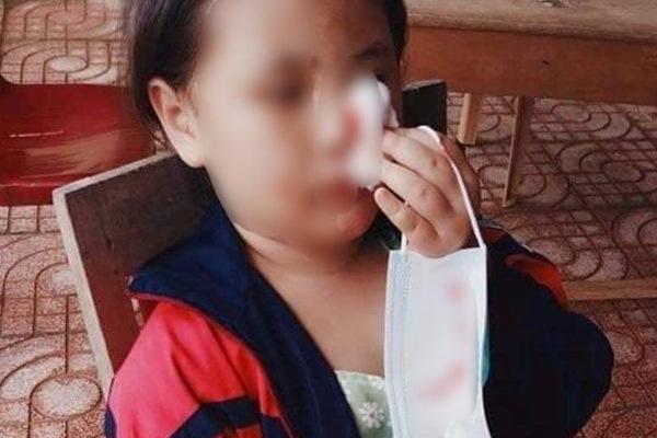 Little girl holding her nose, her shirt wet with blood after testing for Covid-19