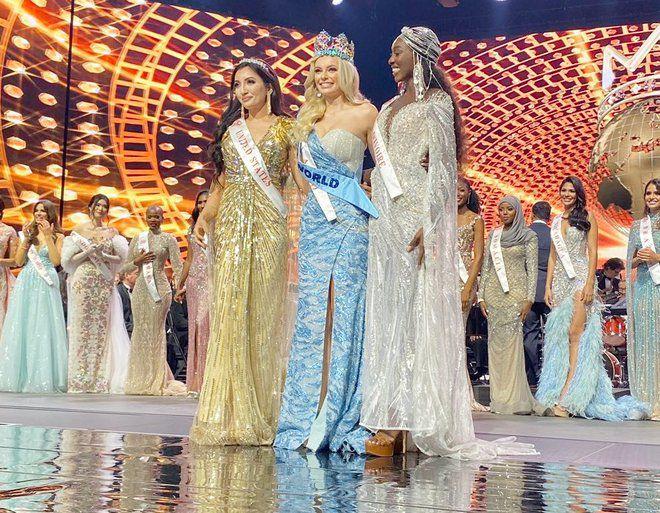 The miraculous show of the Miss World runner-up after a serious burn accident-2