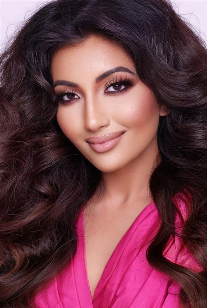 Màn tuốt mặt kỳ diệu của Á hậu Miss World sau tai nạn bỏng nặng-4