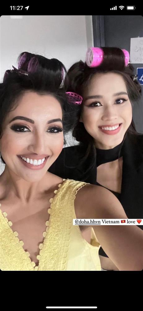 Màn tuốt mặt kỳ diệu của Á hậu Miss World sau tai nạn bỏng nặng-8