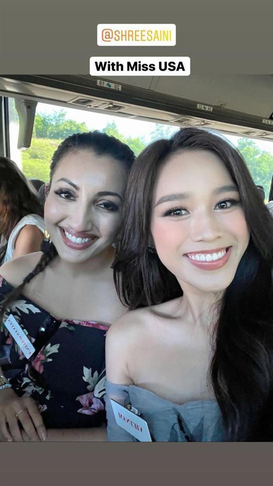 Màn tuốt mặt kỳ diệu của Á hậu Miss World sau tai nạn bỏng nặng-9