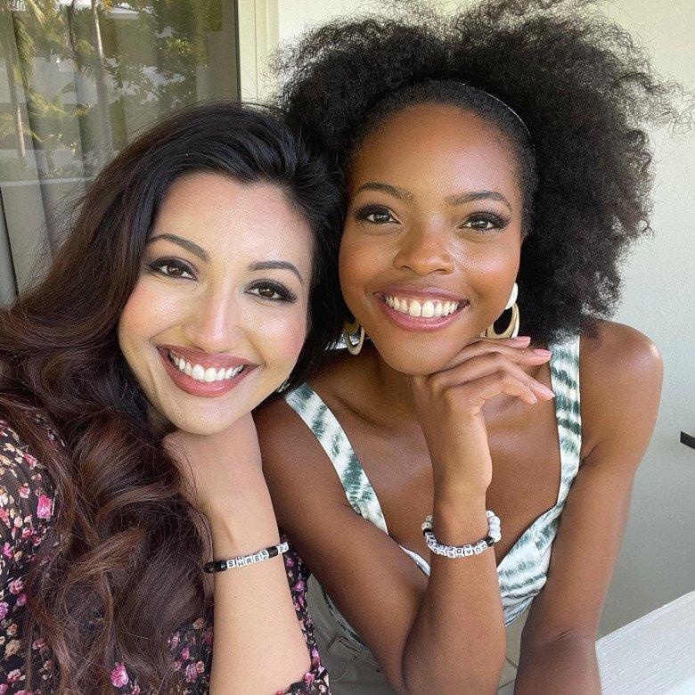 Màn tuốt mặt kỳ diệu của Á hậu Miss World sau tai nạn bỏng nặng-10