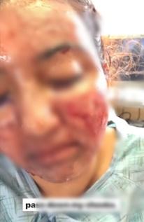 Màn tuốt mặt kỳ diệu của Á hậu Miss World sau tai nạn bỏng nặng-7