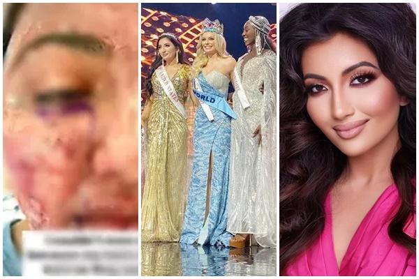 Cùng váy đen sì ở Miss World, Đỗ Hà chưa nhọ bằng Mai Phương Thúy-7