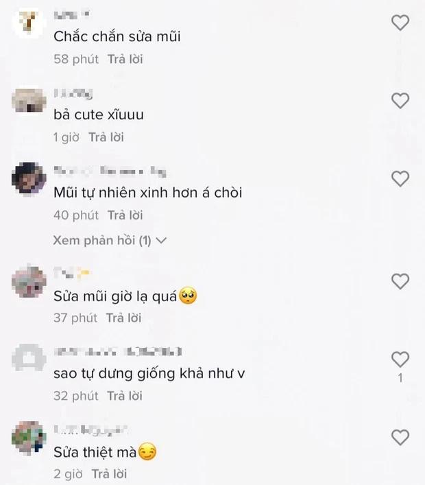 LyLy vướng nghi vấn dao kéo, dân tình nhìn sao mà ra Khả Như?-2