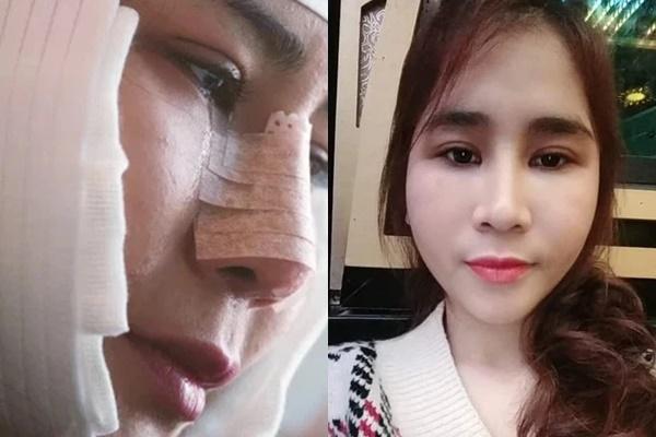 The girl who changed her life after 5 plastic surgeries