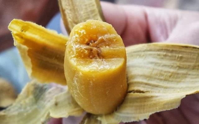 5 cách tự nhiên giúp giảm nhanh tình trạng trào ngược dạ dày-2