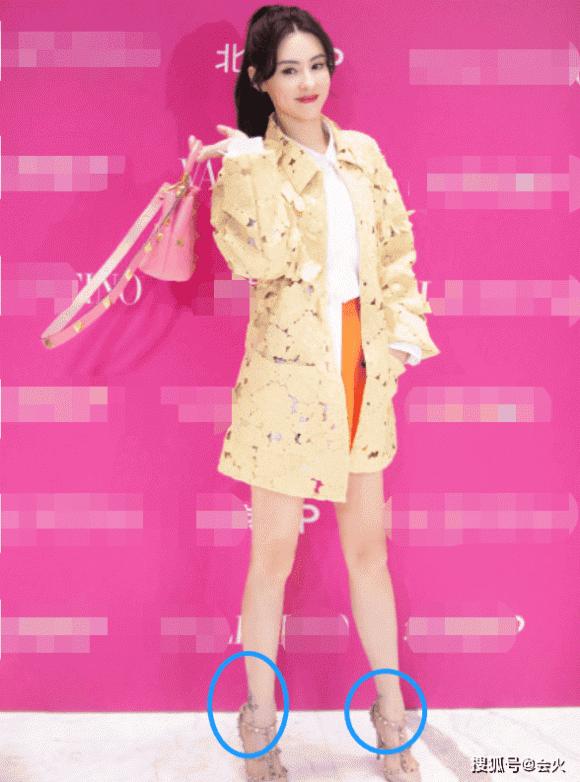 Trương Bá Chi đi giày 35 triệu, bắp chân nhô ra người người chỉ trỏ-2