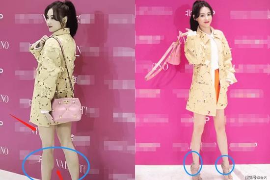 Trương Bá Chi đi giày 35 triệu, bắp chân nhô ra người người chỉ trỏ