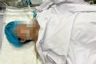 Cô gái tử vong vì phẫu thuật nâng ngực tại Bệnh viện 1A TP HCM
