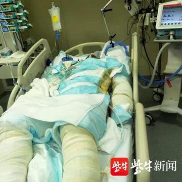 Người chồng cứu vợ khỏi đám cháy ở Trung Quốc đã qua đời-2