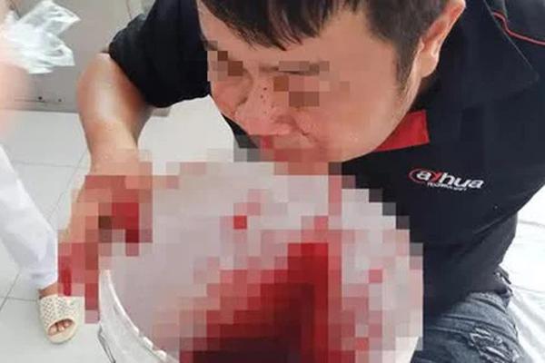 Massive nosebleed, the guy picked up the bucket and ran to the hospital for help
