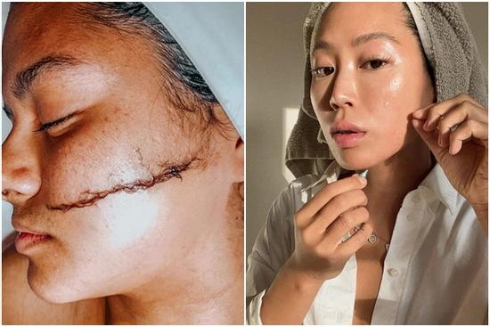 Trào lưu cạo lông mặt