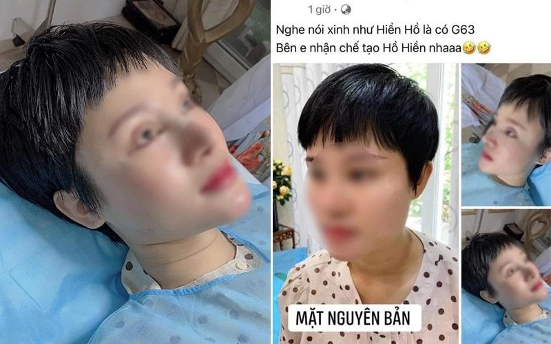 Hết hồn cô gái thẩm mỹ giống Hiền Hồ hòng đổi đời tậu G63-1