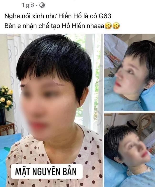 Hết hồn cô gái thẩm mỹ giống Hiền Hồ hòng đổi đời tậu G63-2