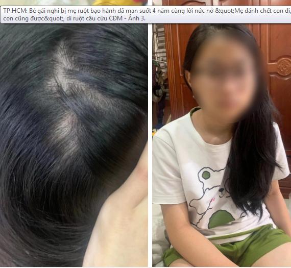 Clip bé gái bị mẹ đẻ đánh như kẻ thù, dì ruột phải cầu cứu CĐM-1