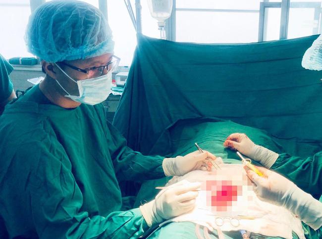 Vụ cắt của quý chồng: Các tình tiết giảm nhẹ cho người vợ là gì?-1