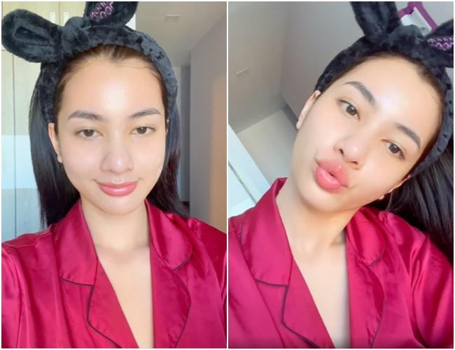 Đẹp như Cẩm Đan cũng bị mụn hành cho nhan sắc hoang toàn-4