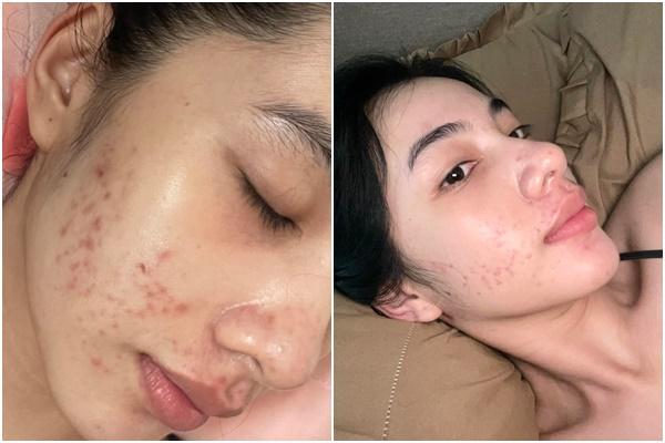 Cẩm Đan đẹp có tiếng vẫn thất thế sự kiện vì mặt chảo dầu-10