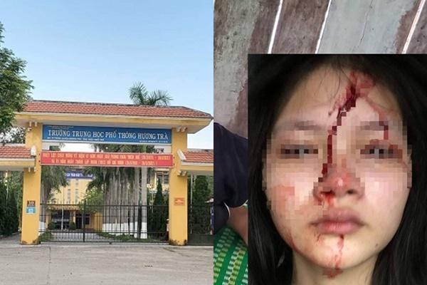 Nữ sinh lớp 10 bị bạn đánh chấn động não: Mẹ đẻ nghẹn ngào kể lại-6