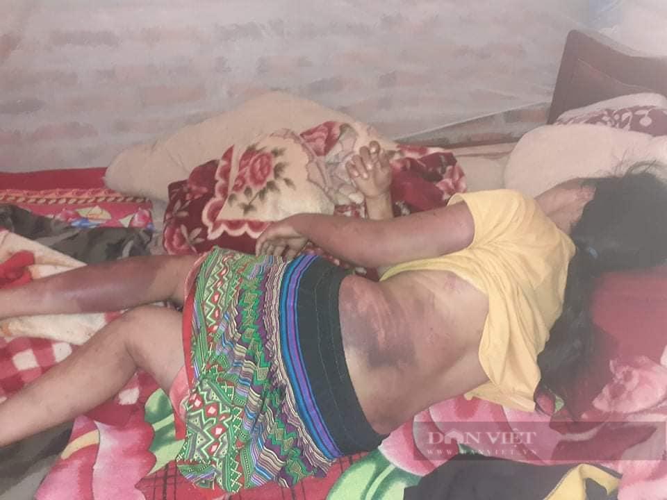 Chồng đánh vợ nhập viện chỉ vì... giặt quần không sạch-1