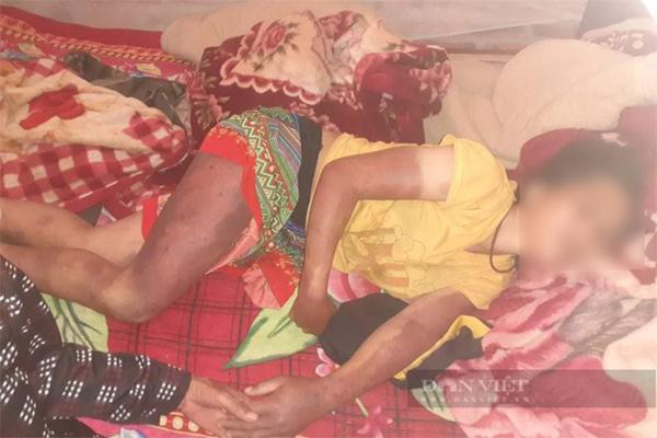 Chồng đánh vợ nhập viện chỉ vì... giặt quần không sạch-2