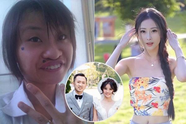 The girl with plastic surgery, married a rich Vietnamese overseas