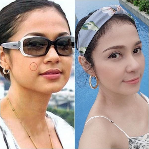 Mai Phuong Thuy and a series of Vietnamese beauties promoted thanks to mole removal-9