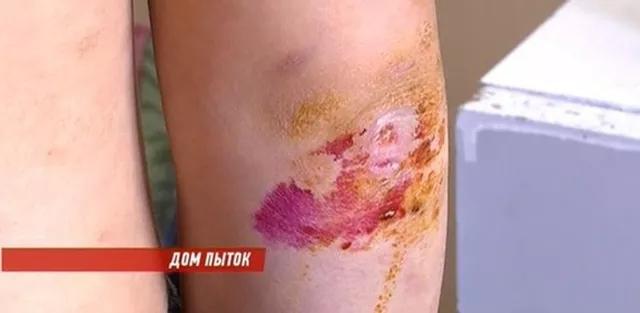 Giao các con cho vợ kế, bố bật khóc khi nhìn con trong bệnh viện-1